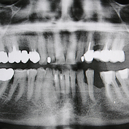 Imagerie dentaire maxillo-faciale